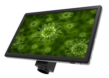 China Full HD 16 MP Microscope Accessories LCD Screen UOP XSP-16.0 Black supplier